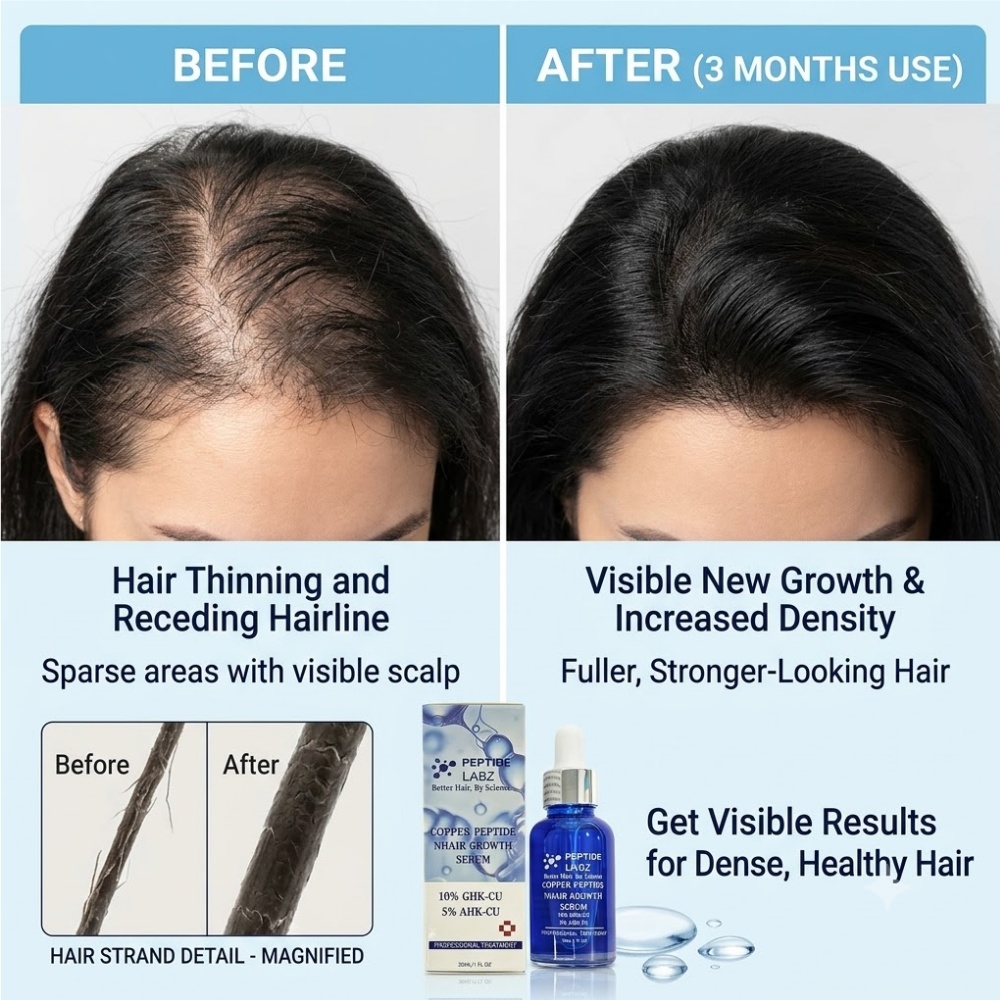 سيروم نمو الشعر بببتيد النحاس  - مراجعة Growth Factor Serum وسعره