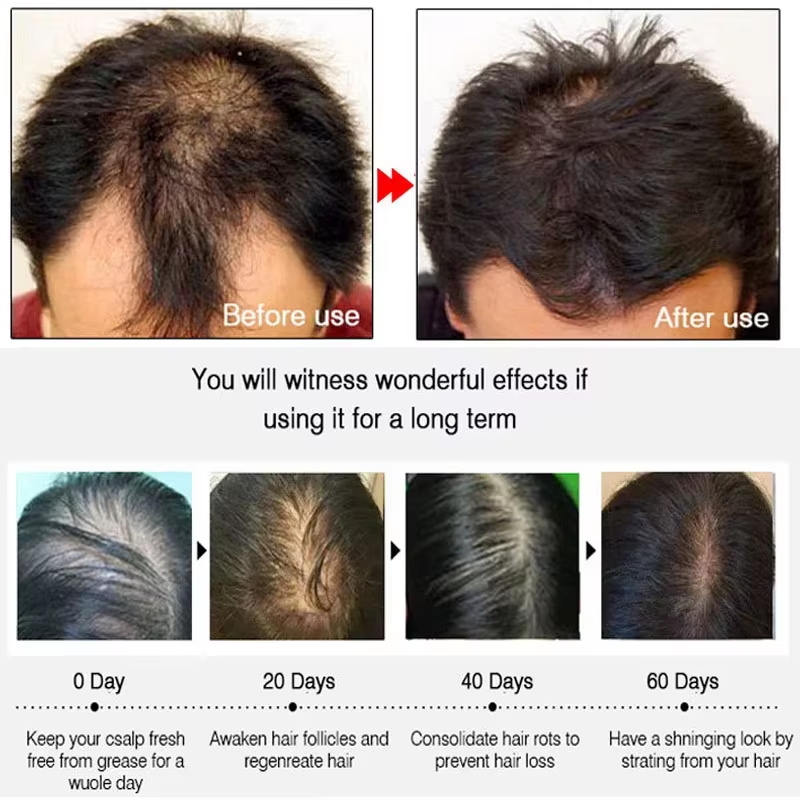 بخاخ الزنجبيل السريع لنمو الشع - مراجعة Growth Factor Serum وسعره